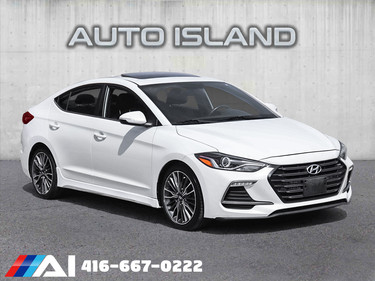 2017 Hyundai Elantra DCT Sport